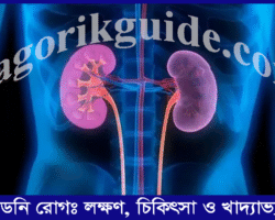 সুস্থ কিডনির লক্ষণ: কিডনি রোগের লক্ষণ, চিকিৎসা ও খাদ্যাভ্যাস সুস্থ কিডনির লক্ষণ: কিডনি রোগের লক্ষণ, চিকিৎসা ও খাদ্যাভ্যাস
