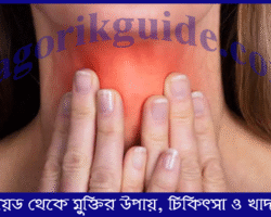 থাইরয়েডের সমস্যা থেকে মুক্তির ঘরোয়া উপায়: প্রাকৃতিক চিকিৎসা ও খাদ্যাভ্যাস