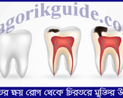 দাঁতের ক্ষয় রোগ থেকে চিরতরে মুক্তির উপায়