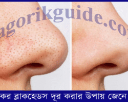 নাকের ব্ল্যাকহেডস দূর করার উপায়: দ্রুত সমাধান জেনে নিন নাকের ব্ল্যাকহেডস দূর করার উপায়