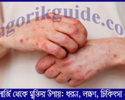স্কিন এলার্জি থেকে মুক্তির উপায়: ধরন, লক্ষণ, চিকিৎসা ও ওষুধ স্কিন এলার্জি থেকে মুক্তির উপায়: ধরন, লক্ষণ, চিকিৎসা ও ওষুধ