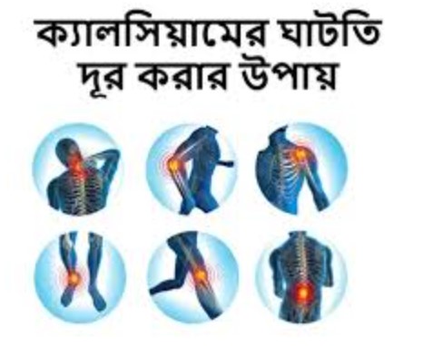 ক্যালসিয়ামের ঘাটতি পূরণের উপায়